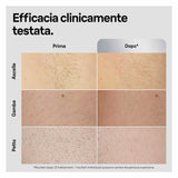 Electric Hair Remover Braun-5